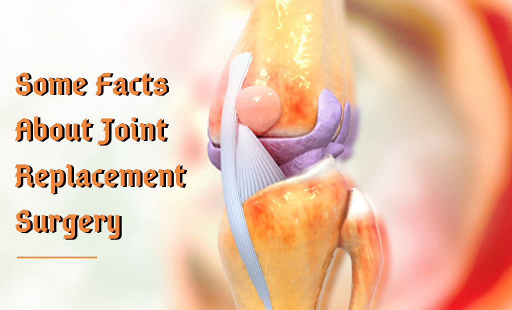 Some Facts About Joint Replacement Surgery