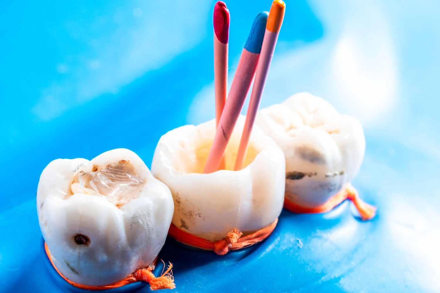 What to expect when a tooth is extracted.